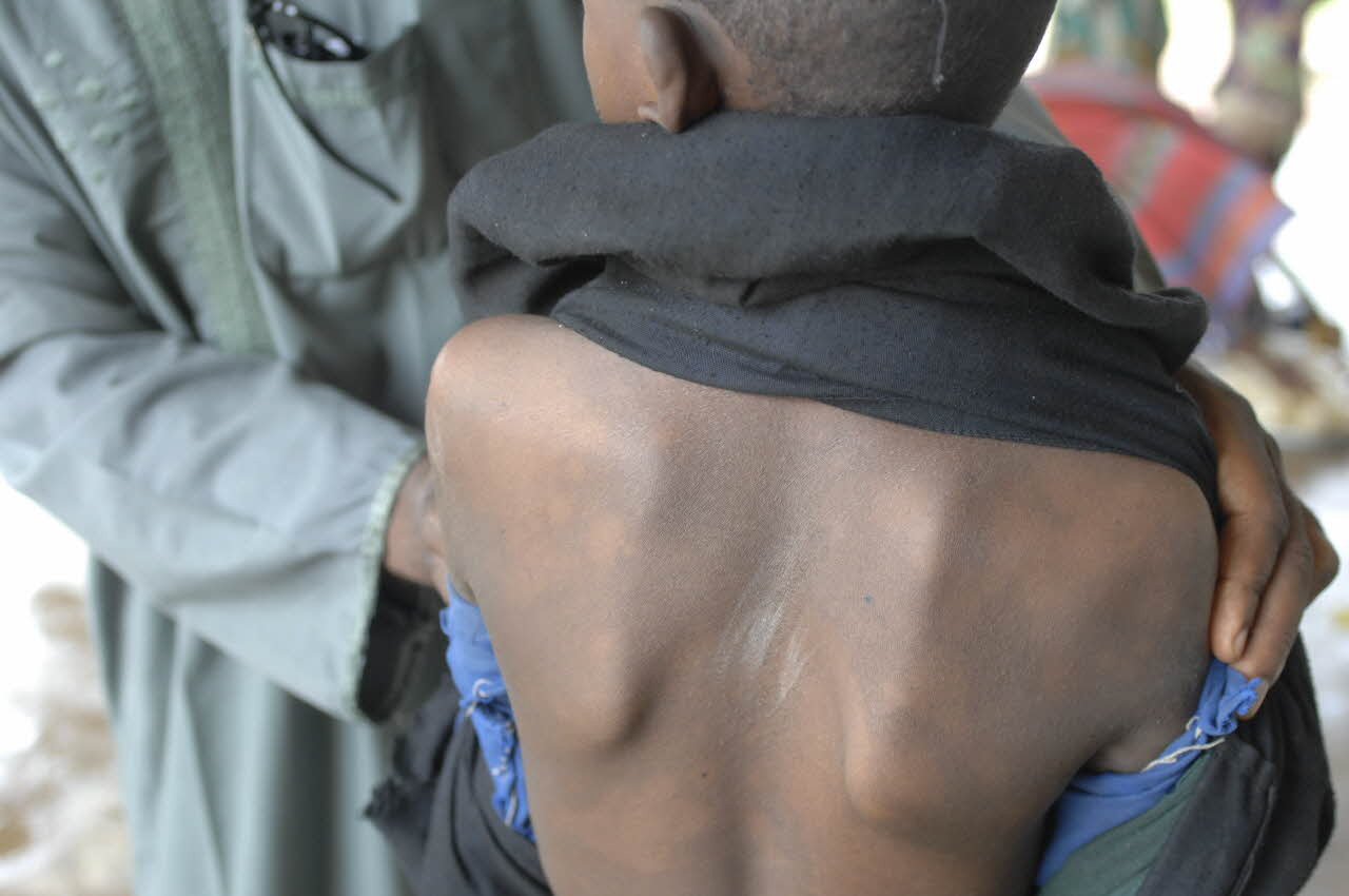 Patient being examined